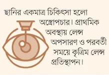 জন্মগত ছানির প্রতিকার