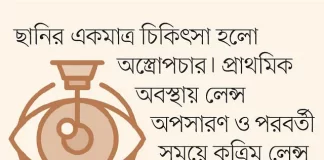 জন্মগত ছানির প্রতিকার