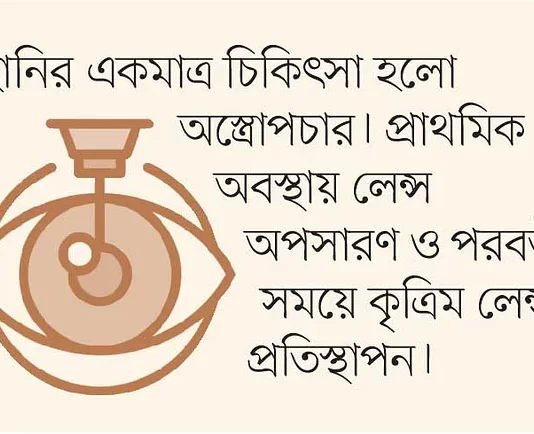 জন্মগত ছানির প্রতিকার